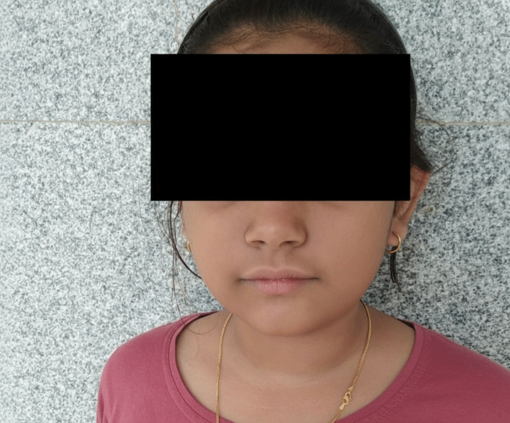 white patches girl after